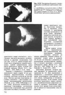 Узи зрительного нерва