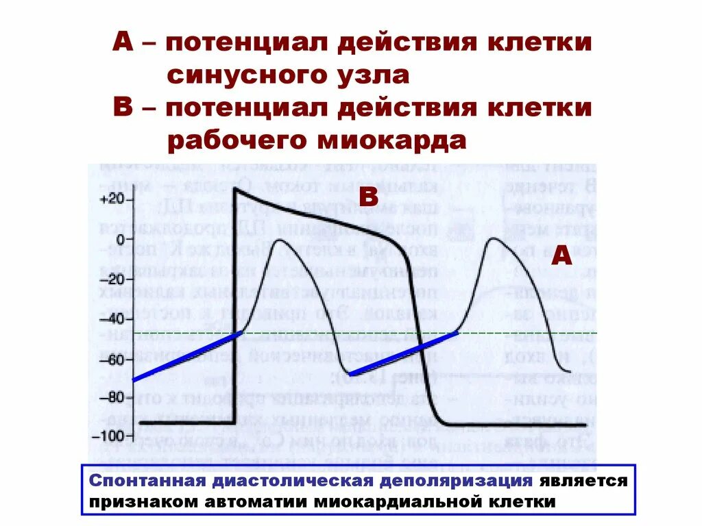 Распространение пд. Мембранный потенциал синусного узла. Фазы Пд пейсмекерных клеток. Потенциал действия клеток синусного узла. Потенциал действия клетки рабочего миокарда.