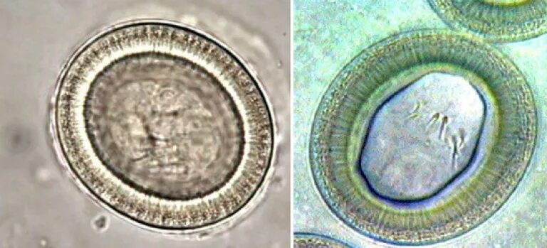 Яйца бычьего цепня микроскоп. Яйцо (онкосфера) тениид. Онкосфера свиного цепня. Яйца гельминтов бычьего цепня. Яйцо с онкосферой