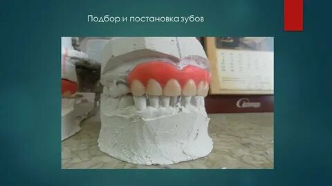 Постановка искусственных