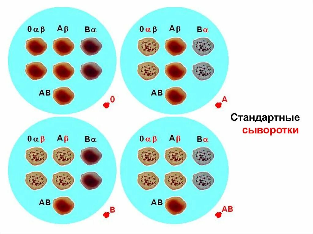 Метод стандартных сывороток группы крови. Стандартные изогемагглютинирующие сыворотки. Гемагглютинирующие сыворотки определение групп крови. Стандартные изогемагглютинирующие сыворотки для определения группы. P ab 0