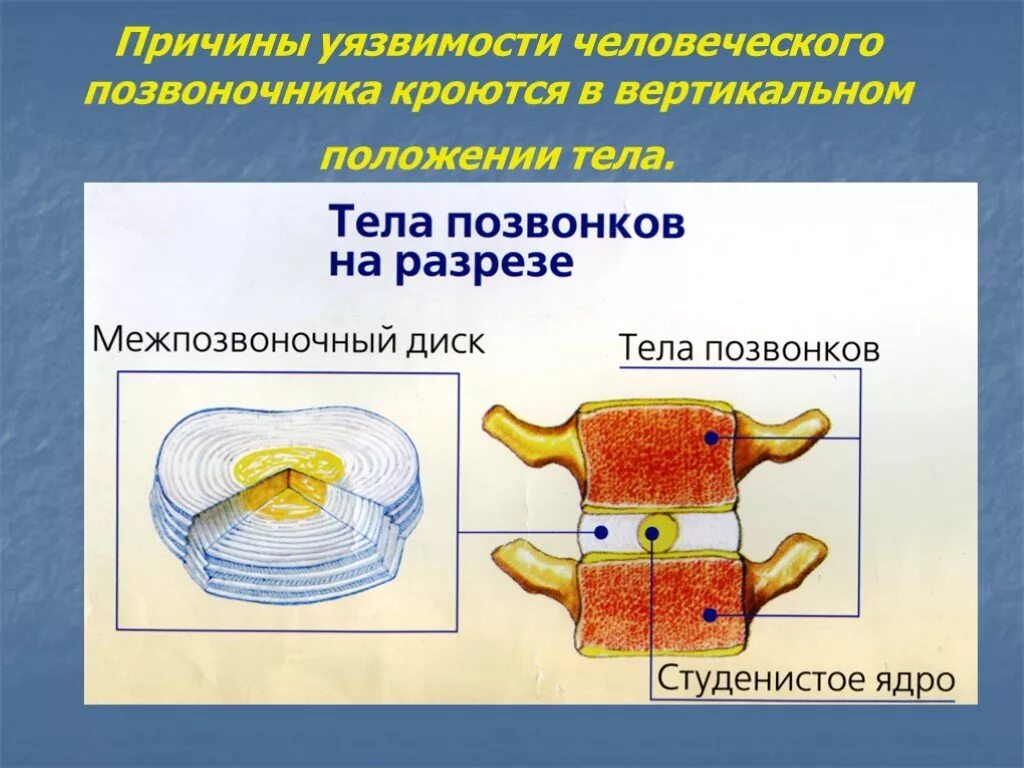 Содержимое межпозвоночного диска. Студенистое яддро межпозвоночногодиска. Студенистое ядро межпозвоночного. Позвоночник в разрезе. Межпозвоночный диск.