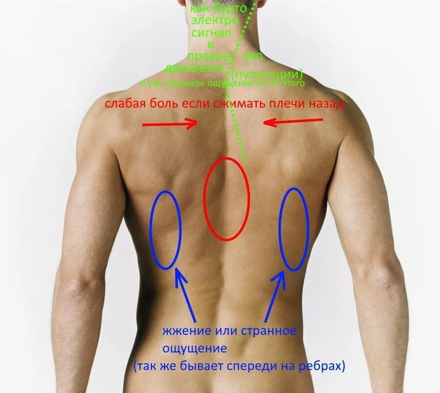 Боль со стороны спины. Локализация боли в спине. Боль в спине под левой лопаткой. Болит под лопаткой. Лёгкие со стороны спины.