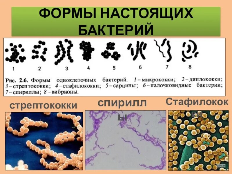Царство бактерий примеры. Микрококки диплококки стрептококки стафилококки. Формы бактерий биология 10 класс. Подцарство настоящие бактерии. Бактерии формы бактерий.