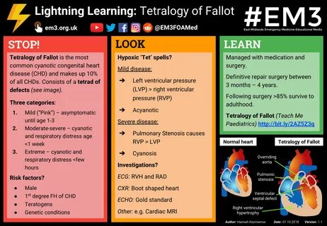 Lightning Learning - Tetralogy of Fallot.png 