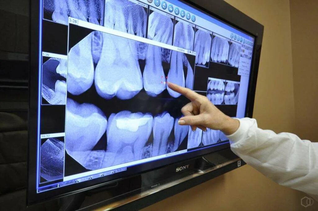 Сделать платный рентген. Внутриротовая рентгенография зубов. Dental визиограф XRAY. Рентгенография лучевая диагностика.
