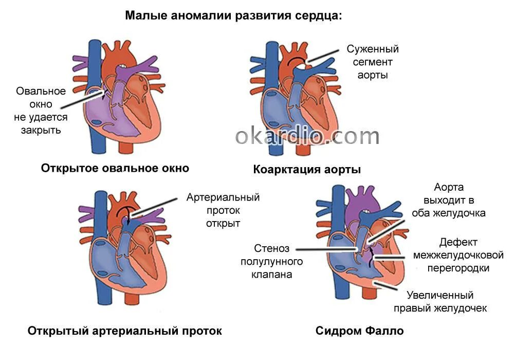 Марс в кардиологии