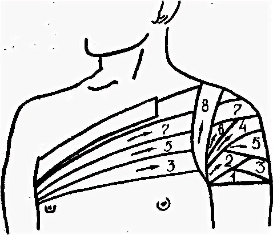 Плечевая повязка алгоритм. Колосовидная повязка на плечевой сустав алгоритм. Наложение колосовидной повязки на плечевой сустав. Наложение колосовидной повязки на плечевой сустав алгоритм. Перевязка колосовидная на плечо.