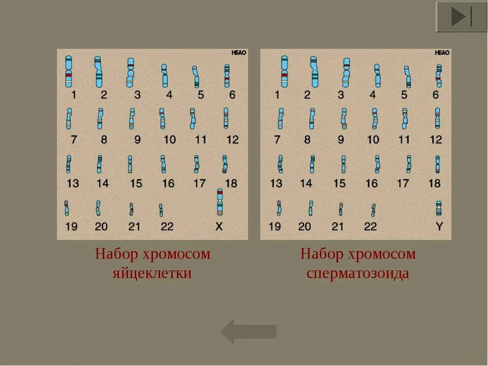 Набор хромосом сперматозоида. Спермий набор хромосом. Хромосомный набор спермия. Хромосомный набор сперматозоидов человека.