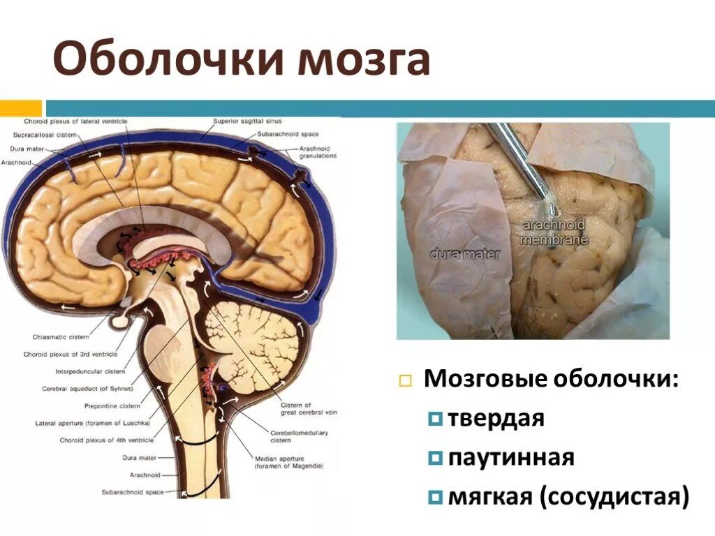 Внутренняя оболочка мозга. Твердая мозговая оболочка головного мозга схема. Паутинная оболочка и твердая мозговая оболочка. Мягкая и паутинная оболочки головного мозга. Паутинная оболочка мозга строение.