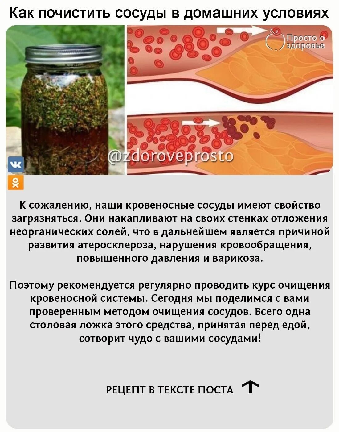 Чистка кровеносных. Как очистить сосуды. чистка сосудов народными средствами. способы чистки сосудов. очищение кровеносных сосудов.