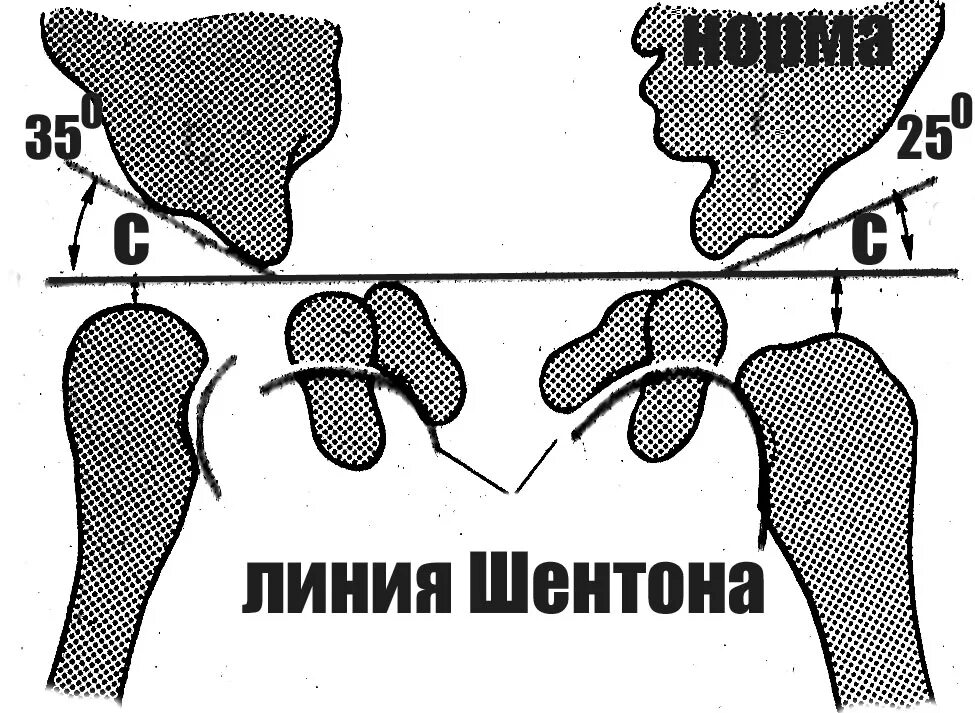 Угол шарпа. Угол шарпа