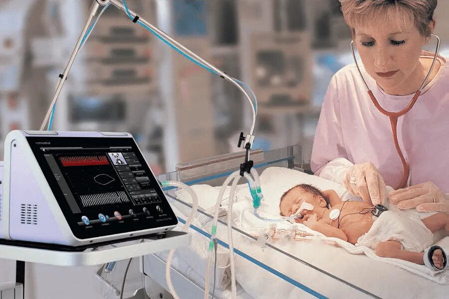 Аппарат ИВЛ неонатальный. ИВЛ недоношенных новорожденных. Аппарат ИВЛ для новорожденных. Аппарат ИВЛ для недоношенных новорожденных.