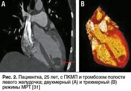 Пациентка 25 лет
