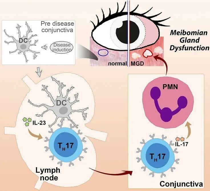 Иммунный глаз. TB immunopathogenesis. Оптиммун тест Ширмера в офтальмологии.