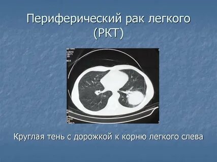 Периферическое образование