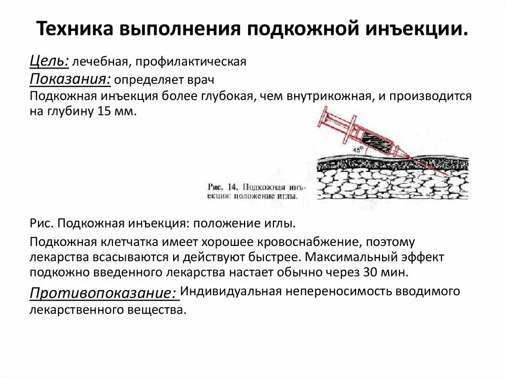 Подкожные инъекции техника выполнения. Алгоритм подкожной инъекции алгоритм. Схема техника выполнения подкожной инъекции. Алгоритм введения подкожной инъекции детям:. Продемонстрируйте технику выполнения подкожной инъекции..