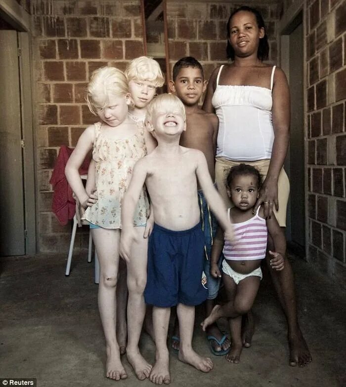 Сколько поколений живет в семье. Альбиносы африканцы Танзания. Танзания люди альбиносы. Альбинос человек Африканский.