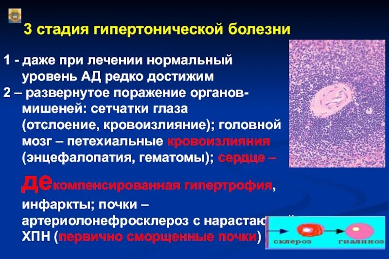 3 стадия 2 степени гипертония. Гипертоническая болезнь 1 стадии. Гипертония 3 степени. Гипертония 3 стадии. Поражение органов мишеней при гипертонической болезни 2 стадии.