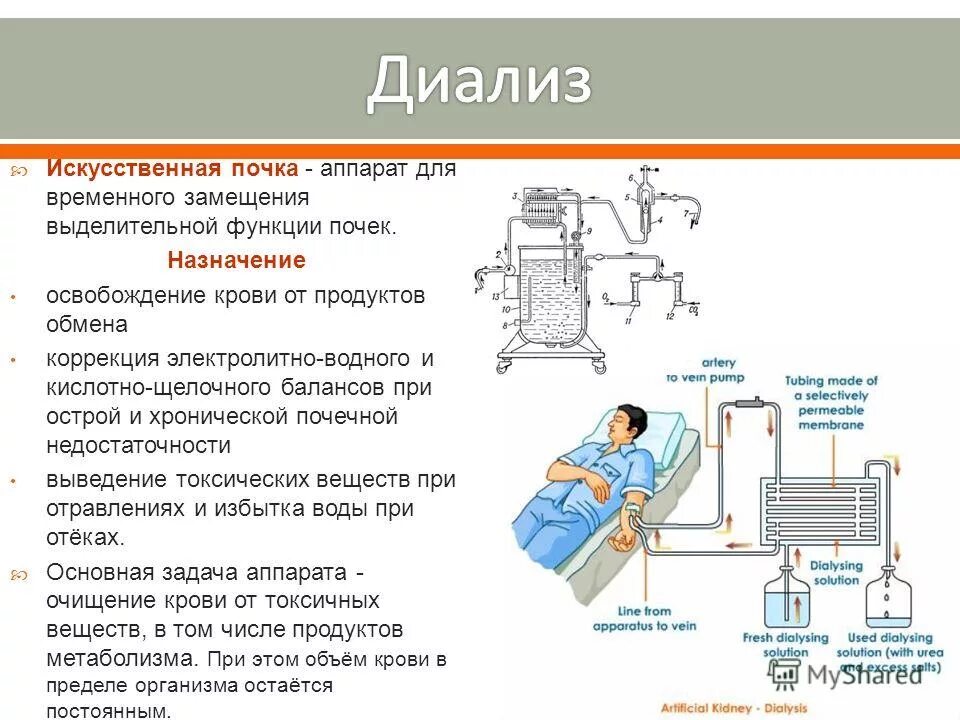 типы диализа почек