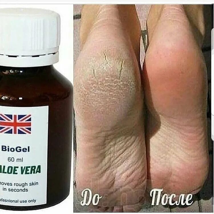 Гель для пяток для педикюра. Bio Gel Aloe Vera для педикюра 60мл. Биогель для педикюра Biogel + Aloe Vera (кератогель) 60ml.