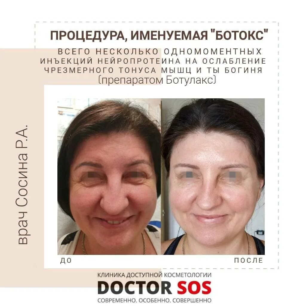 Рекомендации после ботокса лица. Памятка ботулинотерапия. рекомендации после ботулинотерапии. рекомендации после введения ботокса. рекомендации после ботулинотерапии лица.