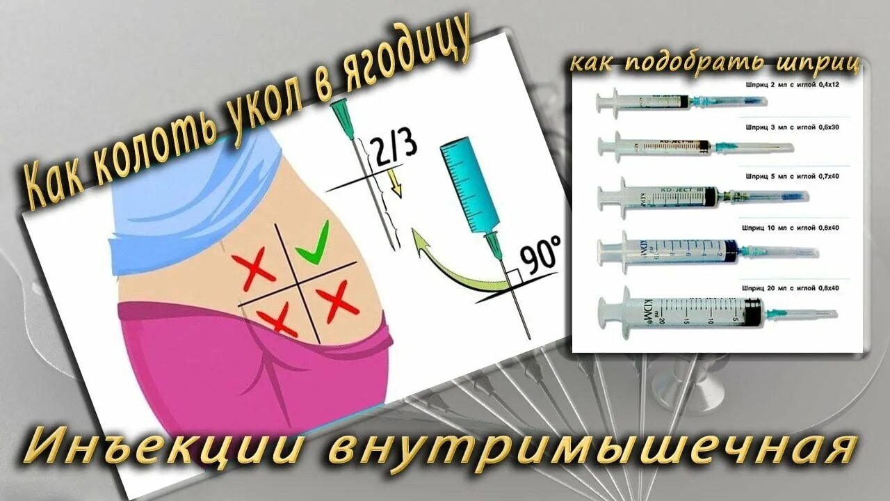 Где можно колоть. Как правильно делать укол. Как правильно делать укол внутримышечно. Как сделать укол в ягодицу. Как правильно делать УК.