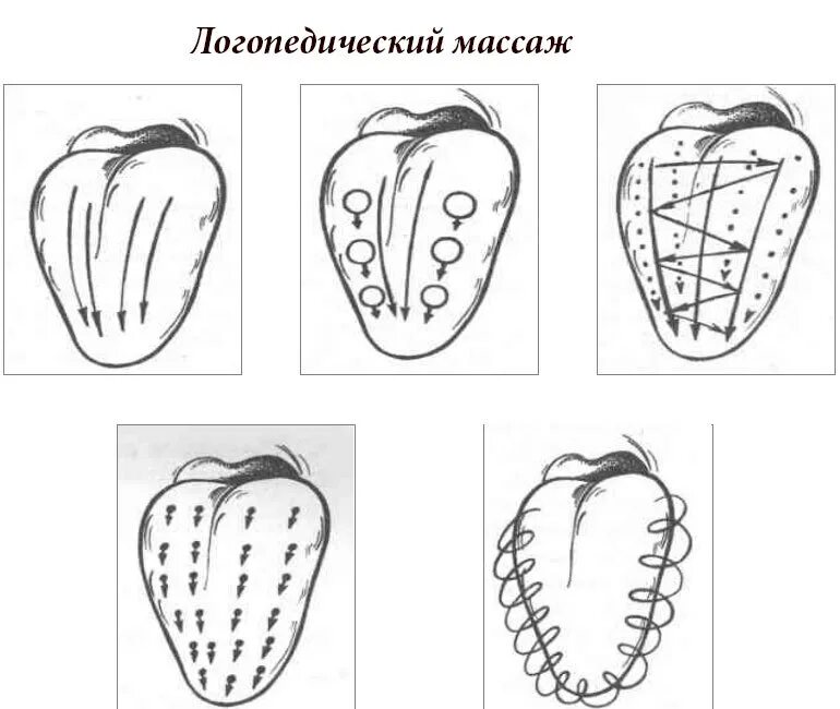 Логопедический массаж языка при дизартрии ребенку. Массаж зубной щеткой логопедический при дизартрии. Массаж языка логопедический ребенку для развития речи. Массаж языка при дизартрии у детей.