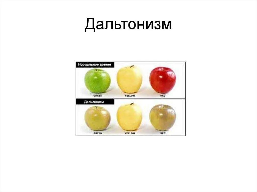 Не различает зеленый цвет. Дальтонизм. Дальтонизм это болезнь. Дальтонизм у женщин. Виды дальтонизма.