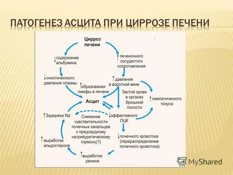 Синдром асцита. Механизм развития печеночных отеков. Панкреатический асцит патогенез. Асцит механизм развития. Механизмы развития синдромы цирроза печени.