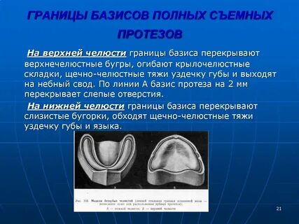 Частичная область