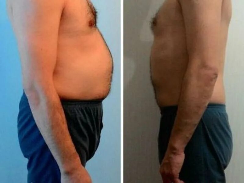 Как убрать большой живот у мужчин. Огромные бока у мужчин. Как убрать большой живот у мужчин. Мужчина с большим животом. Живот до и после тренировок.