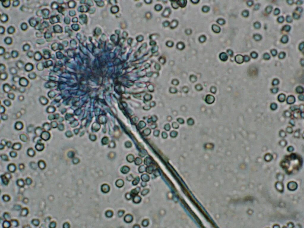 Патогенные грибы споры. Микроскопия аспергилл. Мицелий Aspergillus. Споры грибов аспергиллез. Aspergillus микроскопия.