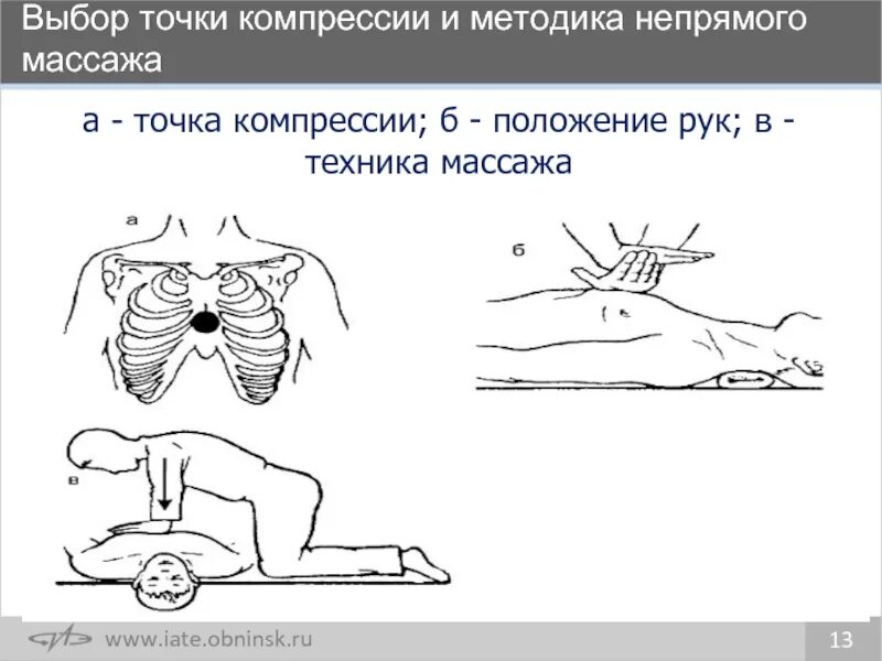 Тоска компрессии при СЛР. Непрямой массаж сердца точка компрессии. Точка компрессии при СЛР. Компрессия грудной клетки при непрямом массаже сердца