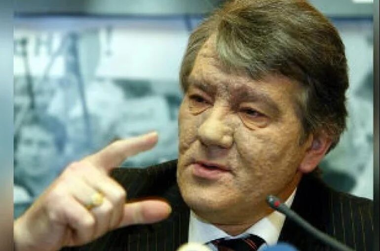 Ющенко лепра. Ющенко лепра. Ющенко лепра. Ющенко лепра. Ющенко.