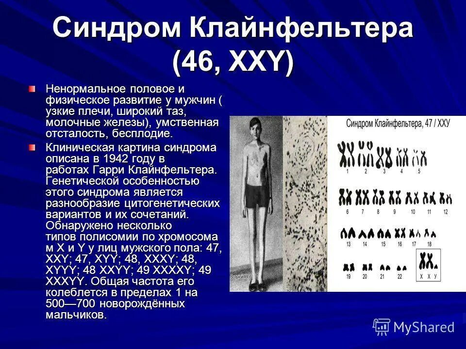 Xxy хромосома. Синдром Шерешевского Клайнфельтера. Основные клинические симптомы синдрома Клайнфельтера:. Обязательный диагностический признак синдрома Клайнфельтера. Симптомы синдрома Клайнфельтера,генетика.