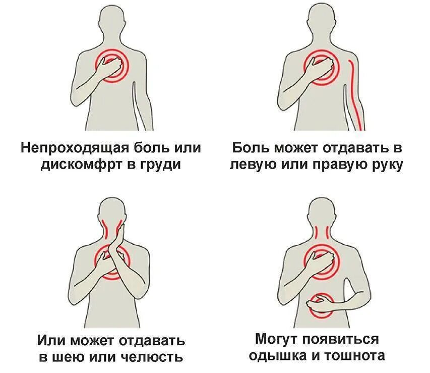 Давящая боль. Стенокардия боль. Сердечные боли.