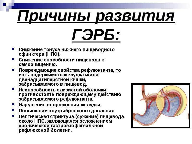 Рефлюксная болезнь желудка симптомы у взрослого