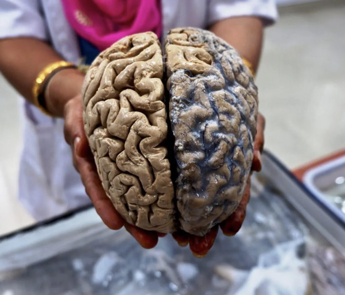 Brain 106. Настоящий человеческий мозг.