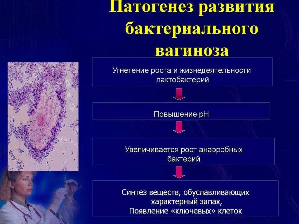 Этиология бактериального вагиноза. Клинические симптомы бактериального вагиноза. Бактериальный вагиноз классификация. Вагинит и вагиноз