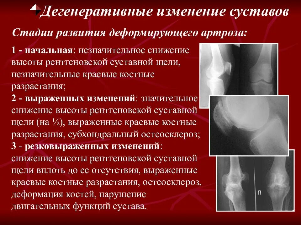 Какие бывают заболевания костей