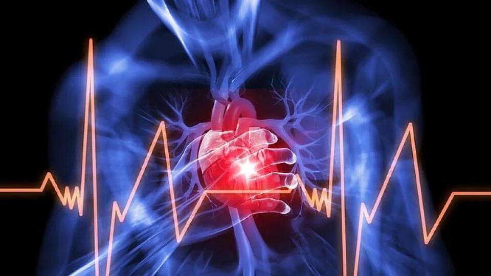 Аритмия и гипертония. Нарушение ритма. Нарушение сердечного ритма. Сердечные аритмии. Заболевания сердца аритмия.