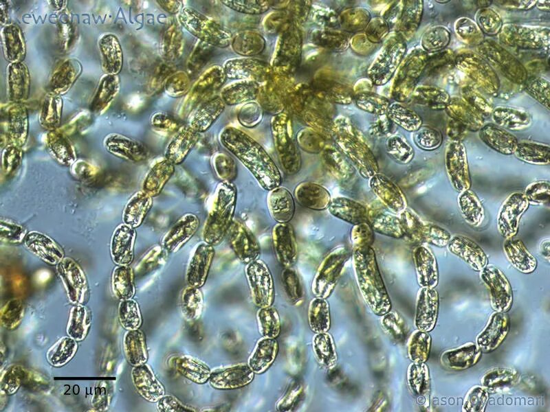 Анабена. Цианобактерия anabaena. цианобактерии anabaena azollae. anabaena lemmermanii. синезеленые водоросли анабена.