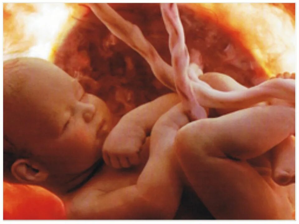 узи ребенка на 31 неделе беременности.