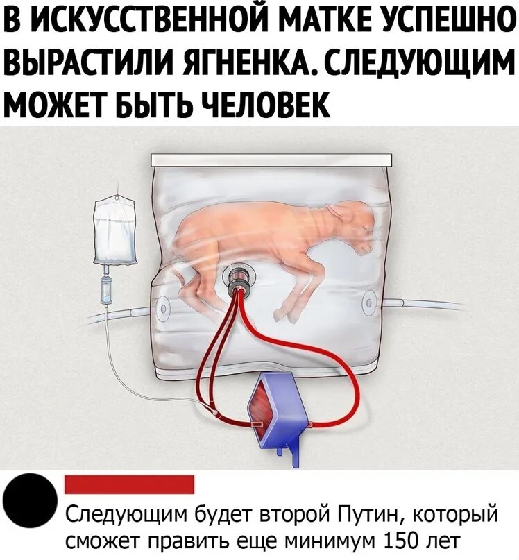 Ягненок в искусственной матке. Искусственно выращенный ягненок. Искусственная матка для людей.