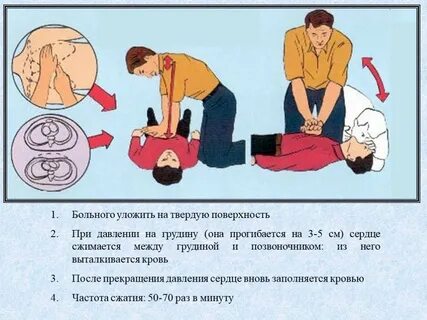 Давление на грудину