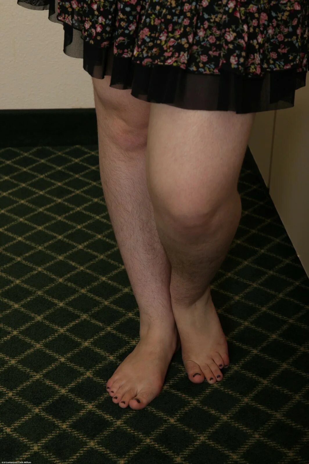 Не ьритые женские ноги. Волосатые женские ножки. Юбка сволсатыми ногами. Волосатые ноги теток