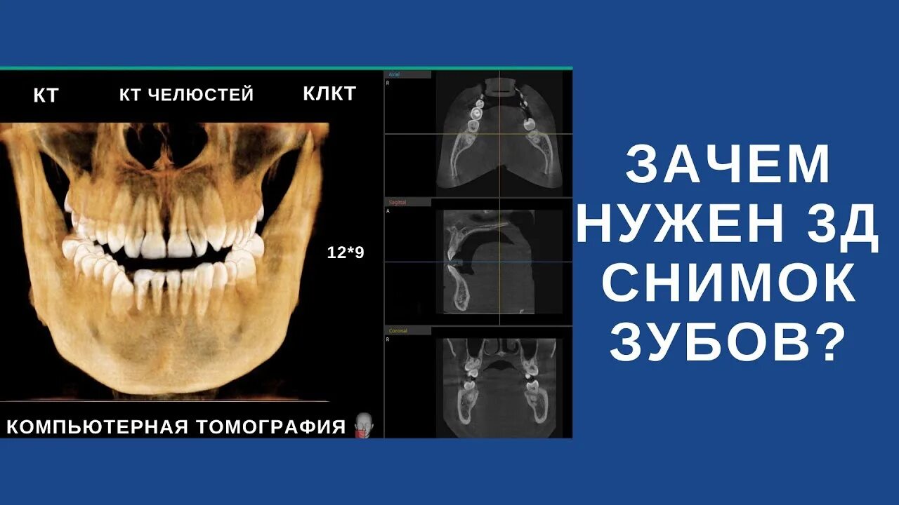 Сделать кт зубов в ульяновске недорого. КЛКТ (конусно-лучевая компьютерная томография). Кт челюсти (конусно-лучевая компьютерная томография). 3д конусно-лучевая компьютерная томография.