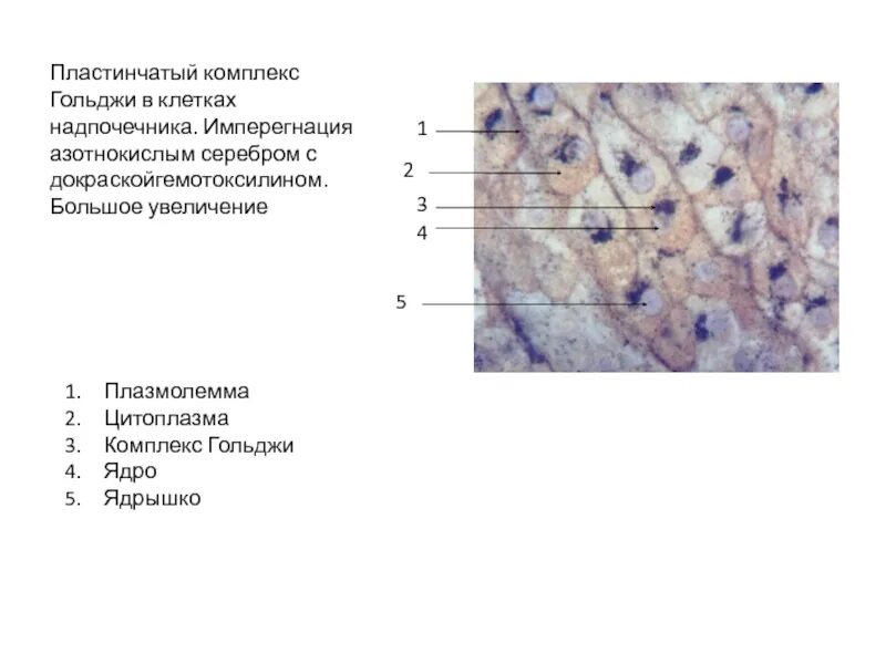 Увеличение больших половых. Пластинчатый комплекс Гольджи гистология. Пластинчатый комплекс Гольджи гистология препарат. Комплекс Гольджи в нейронах спинального ганглия. Комплекс Гольджи импрегнация серебром гистология.