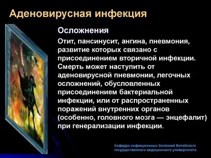 Аденовирус глаз
